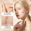 Silicon Scar Removal Stick