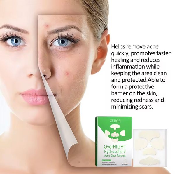 Pimple Patch Mask For Full Face