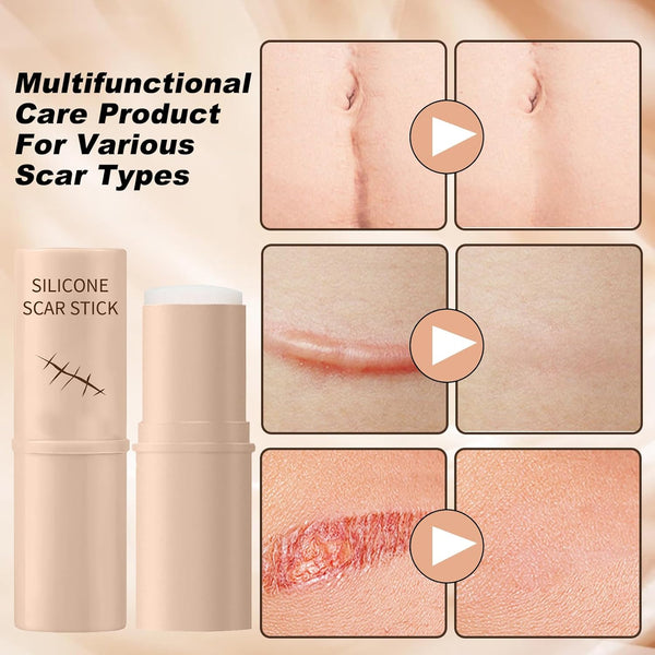 Silicon Scar Removal Stick