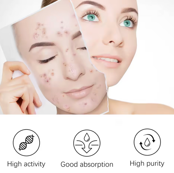 Pimple Patch Mask For Full Face
